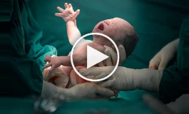 عواقب خطرناک زایمان‌های تقویمی و لاکچری